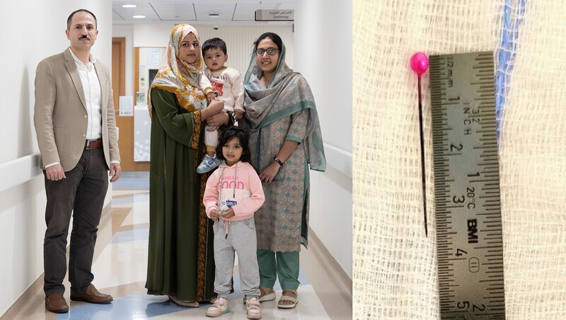 Tamim, an 18-month-old boy, was in a life-threatening condition after accidently ingesting a 5cm-long abaya pin.