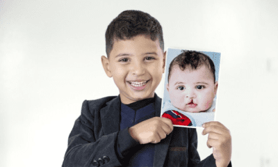 UAE Provides Free Life-Changing Surgeries to Children with Cleft Conditions This Eid Al-Fitr